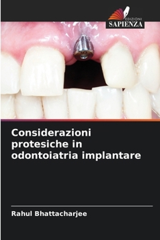 Paperback Considerazioni protesiche in odontoiatria implantare [Italian] Book