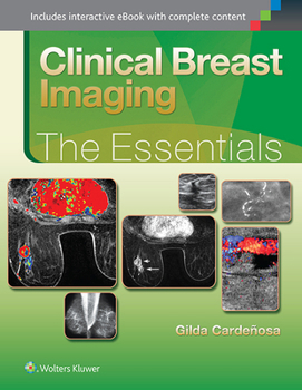 Hardcover Clinical Breast Imaging: The Essentials Book