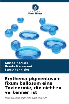 Erythema pigmentosum fixum bullosum eine Toxidermie, die nicht zu verkennen ist (German Edition)