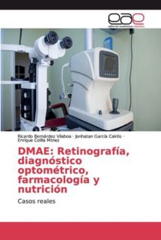 Paperback Dmae: Retinografía, diagnóstico optométrico, farmacología y nutrición [Spanish] Book