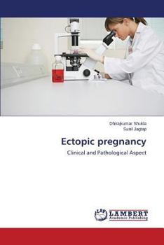 Paperback Ectopic pregnancy Book