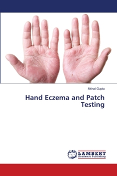 Paperback Hand Eczema and Patch Testing Book