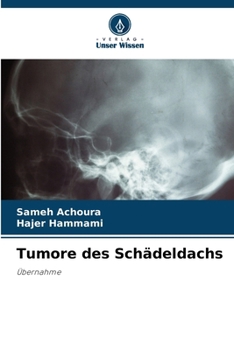 Paperback Tumore des Schädeldachs [German] Book