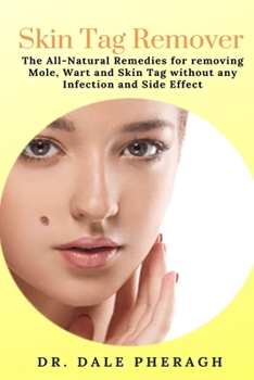 Skin Tag Remover: The All-Natural Remedies for removing Mole, Wart and Skin Tag without any Infection and Side Effect