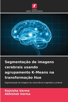 Paperback Segmentação de imagens cerebrais usando agrupamento K-Means na transformação Hue [Portuguese] Book