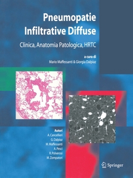 Paperback Pneumopatie Infiltrative Diffuse: Clinica, Anatomia Patologica, Hrtc [Italian] Book