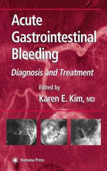 Hardcover Acute Gastrointestinal Bleeding: Diagnosis and Treatment Book