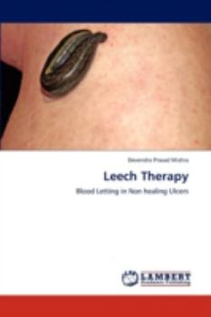 Paperback Leech Therapy Book