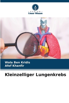 Paperback Kleinzelliger Lungenkrebs (German Edition) [German] Book
