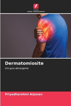 Dermatomiosite (Portuguese Edition)