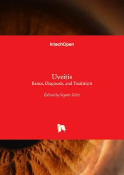 Uveitis - Basics, Diagnosis, and Treatment