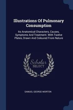 Paperback Illustrations Of Pulmonary Consumption: Its Anatomical Characters, Causes, Symptoms And Treatment. With Twelve Plates, Drawn And Coloured From Nature Book