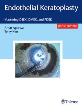 Hardcover Endothelial Keratoplasty: Mastering Dsek, Dmek, and Pdek Book