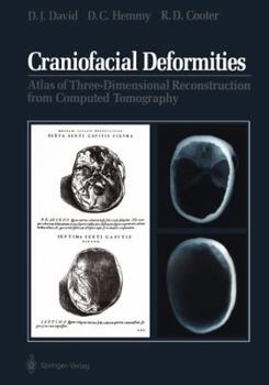 Paperback Craniofacial Deformities: Atlas of Three-Dimensional Reconstruction from Computed Tomography Book