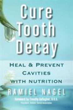Paperback Cure Tooth Decay: Heal and Prevent Cavities with Nutrition Book