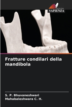 Fratture condilari della mandibola (Italian Edition)