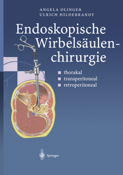 Paperback Endoskopische Wirbelsäulenchirurgie: Thorakal - Transperitoneal - Retroperitoneal [German] Book