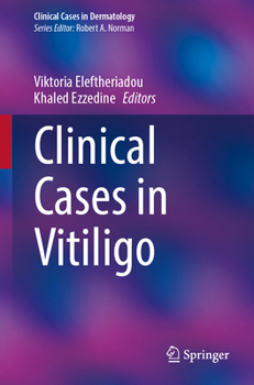 Paperback Clinical Cases in Vitiligo Book