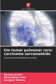 Paperback Um tumor pulmonar raro: carcinoma sarcomatóide [Portuguese] Book