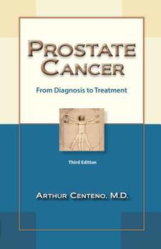 Paperback Prostate Cancer: From Diagnosis to Treatment Book