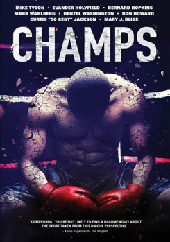 DVD Champs Book