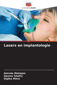 Paperback Lasers en implantologie [French] Book