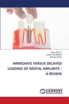 Paperback Immediate Versus Delayed Loading of Dental Implants - A Review Book