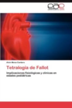 Paperback Tetralogia de Fallot [Spanish] Book
