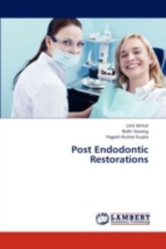 Paperback Post Endodontic Restorations Book