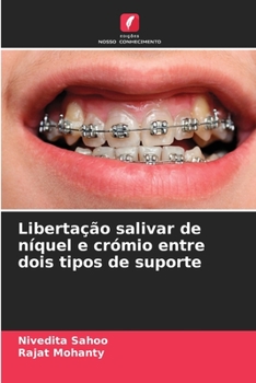 Paperback Libertação salivar de níquel e crómio entre dois tipos de suporte [Portuguese] Book