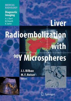 Hardcover Liver Radioembolization with 90y Microspheres Book