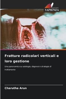 Fratture radicolari verticali e loro gestione (Italian Edition)