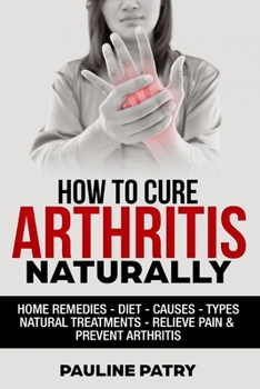 Paperback How to Cure Arthritis Naturally: Home remedies - Diet - Causes - Natural Treatments - Relieve Pain - Prevent Arthritis Book