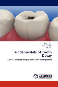 Paperback Fundamentals of Tooth Decay Book