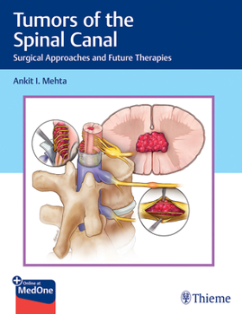 Hardcover Tumors of the Spinal Canal: Surgical Approaches and Future Therapies Book
