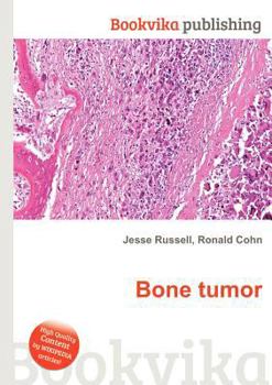 Bone Tumor