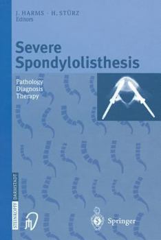 Paperback Severe Spondylolisthesis: Pathology - Diagnosis - Therapy Book