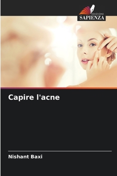 Paperback Capire l'acne [Italian] Book