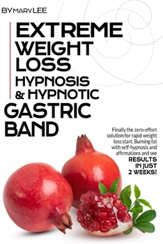 Paperback Extreme Weight Loss Hypnosis & Hypnotic Gastric Band: Finally The Zero-Effort Solution for Rapid Weight Loss. Start Burning Fat with Self-Hypnosis and Book