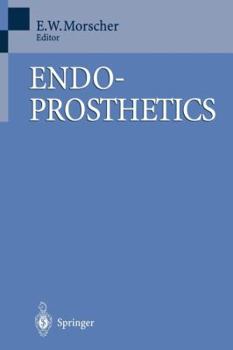 Paperback Endoprosthetics Book