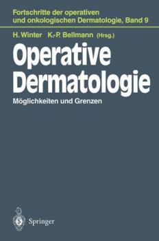 Paperback Operative Dermatologie: Möglichkeiten Und Grenzen [German] Book