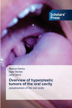 Paperback Overview of hyperplastic tumors of the oral cavity Book