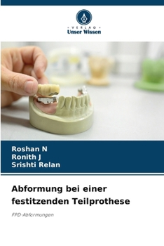 Paperback Abformung bei einer festitzenden Teilprothese [German] Book