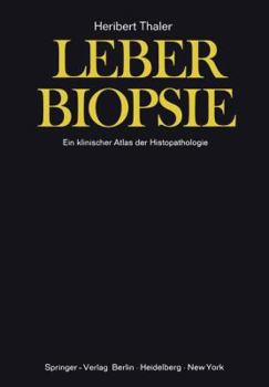 Paperback Leberbiopsie: Ein Klinischer Atlas Der Histopathologie [German] Book