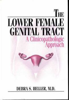 Hardcover The Lower Female Genital Tract: A Clinicopathologic Approach Book