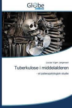 Paperback Tuberkulose I Middelalderen [Danish] Book