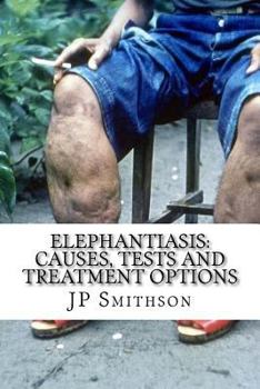 Paperback Elephantiasis: Causes, Tests and Treatment Options Book