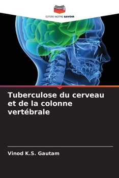 Tuberculose du cerveau et de la colonne vertébrale (French Edition)