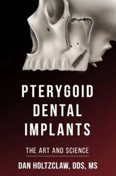 Hardcover Pterygoid Implants: The Art and Science Book