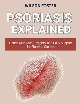 PSORIASIS EXPLAINED: Gentle Skin Care, Triggers, and Daily Support for Flare-Up Control